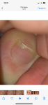 Маленькая царапина на ногте фото 2