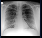 Рентген легких проверить снимок фото 1