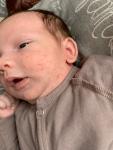 Цветение младенцев или аллергия фото 2