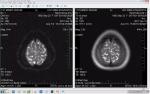 Помогите описать МРТ головного мозга фото 7