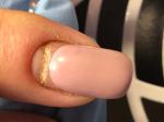 Деформация ногтя отсутствие кутикулы фото 1