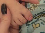 Ребёнок прищемил большой палец ноги фото 3
