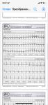 Помогите расшифровать холтер мониторинг фото 4