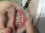 Портятся зубы у ребёнка фото 1