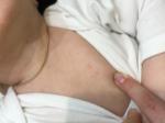 Сыпь на шеи и груди ребёнок 7 месяцев фото 2