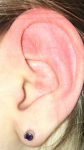 Покраснение уха фото 1
