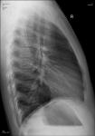 Рентген ребёнка, длительный кашель фото 2