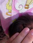 Красное пятно у новорождённого на голове фото 1