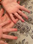 Подушечки пальцев красные у ребёнка фото 2