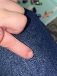 Пятно на пальце у ребёнка на фоне орви фото 1