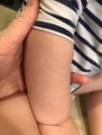 Мелкая сыпь на теле у ребёнка фото 3