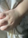 Сыпь у ребёнка на руках фото 1