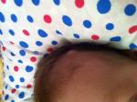 Шишка на голове у ребенка 4 месяца фото 2