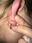 Пульсирующая боль после прокола хряща уха фото 3