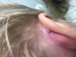 Болезненная шишка за ухом фото 3