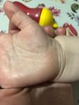 Сыпь на руках у ребёнка фото 1