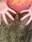 Подушечки пальцев красные у ребёнка фото 1