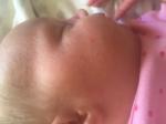 Высыпание на лице у новорождённого фото 3