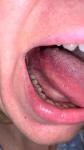 Воспаление языка после ковида фото 1