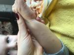 Сыпь на руке у ребёнка фото 3