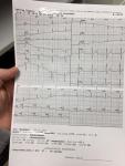 Боли в области сердца, расшифровка кардиограммы фото 1