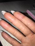Сухость и трещины на пальцах после маникюра фото 1