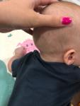 Твердая шишка на голове у ребёнка 6 месяцев фото 3