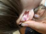 Воспаление в ухе у ребёнка фото 1