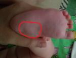 Симметричные шишки на ножках ребенка фото 4