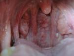 Ощущение кома в горле периодически болит горло фото 2