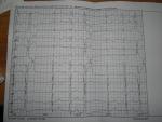 Помогите пожалуйста расшифровать кардиограмму девочки 5 лет, фото 1