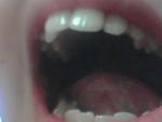 Боль в зубах отдает в десны фото 2