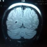 МРТ головного мозга, помогите, пожалуйста фото 5