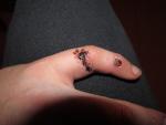 Рана на пальце фото 1