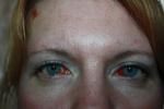 Кровеносные сосуды в глазах фото 1