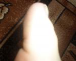 Боль подушечки большого пальца ноги фото 2