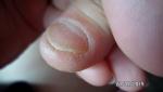 Ногти на пальцах рук фото 3