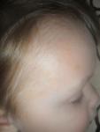 Сыпь у ребенка фото 1