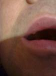 Болезненость губ фото 4