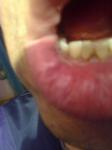 Болезненость губ фото 3