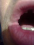 Болезненость губ фото 2