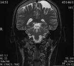 Снимок МРТ головы фото 1