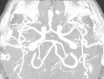 Расшифровка артерий головного мозга фото 1