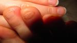 Подозрительная кожа на ногтях и пальцах фото 3