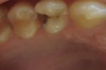 Ноющая боль в зубе фото 1