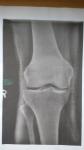 Дисплазия коленных суставов и возможно тазобедренных фото 4
