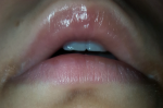 Белая полоса на внутренней части губ фото 1