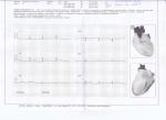 Расшифровка заключения кардиолога фото 1