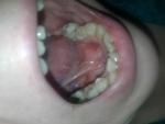 Болит кожа под языком фото 2