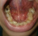 Болит кожа под языком фото 3